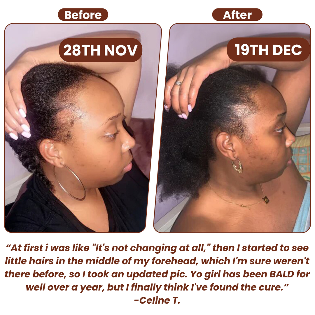 Vexalux™ | 100% Unrefined Batana Oil – Hair Growth, Repair & Deep Scalp Nourishment