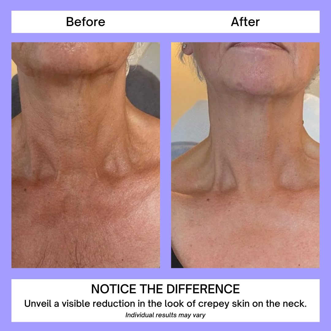 FirmNeck™ | Neck Lift Cream