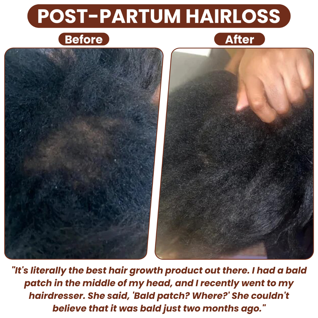 Vexalux™ | 100% Unrefined Batana Oil – Hair Growth, Repair & Deep Scalp Nourishment