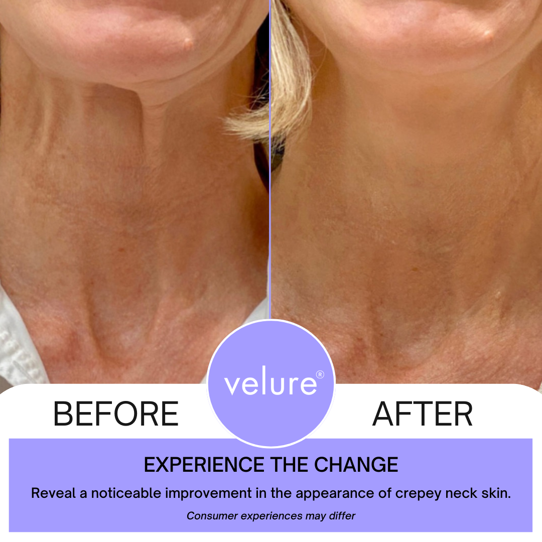 FirmNeck™ | Neck Lift Cream