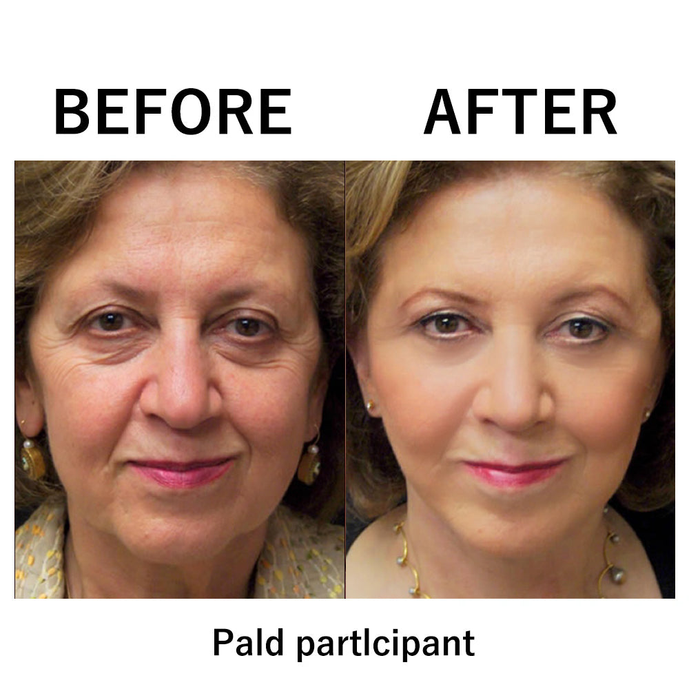 InstantLift™ | Instant Temporary Facial Tightening Cream
