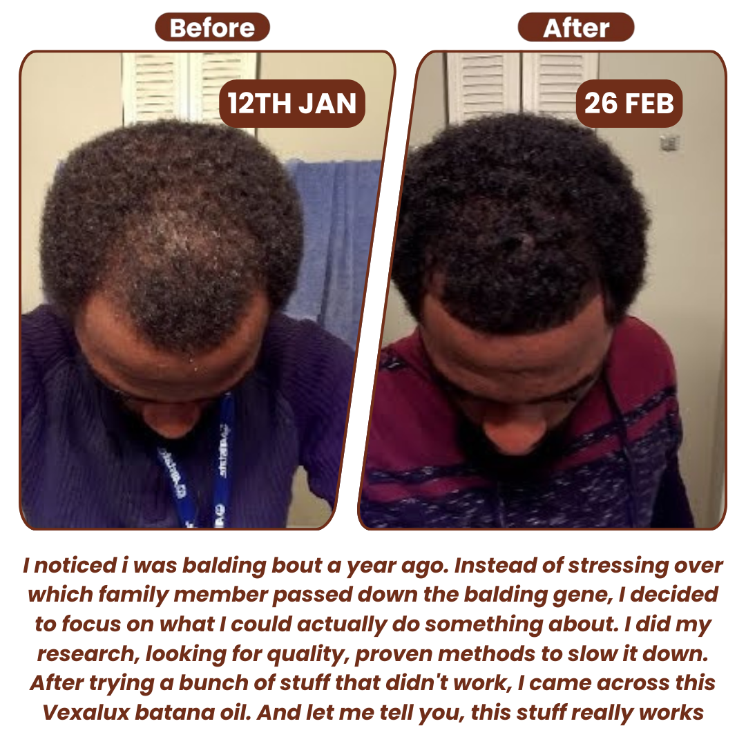 Vexalux™ | 100% Unrefined Batana Oil – Hair Growth, Repair & Deep Scalp Nourishment