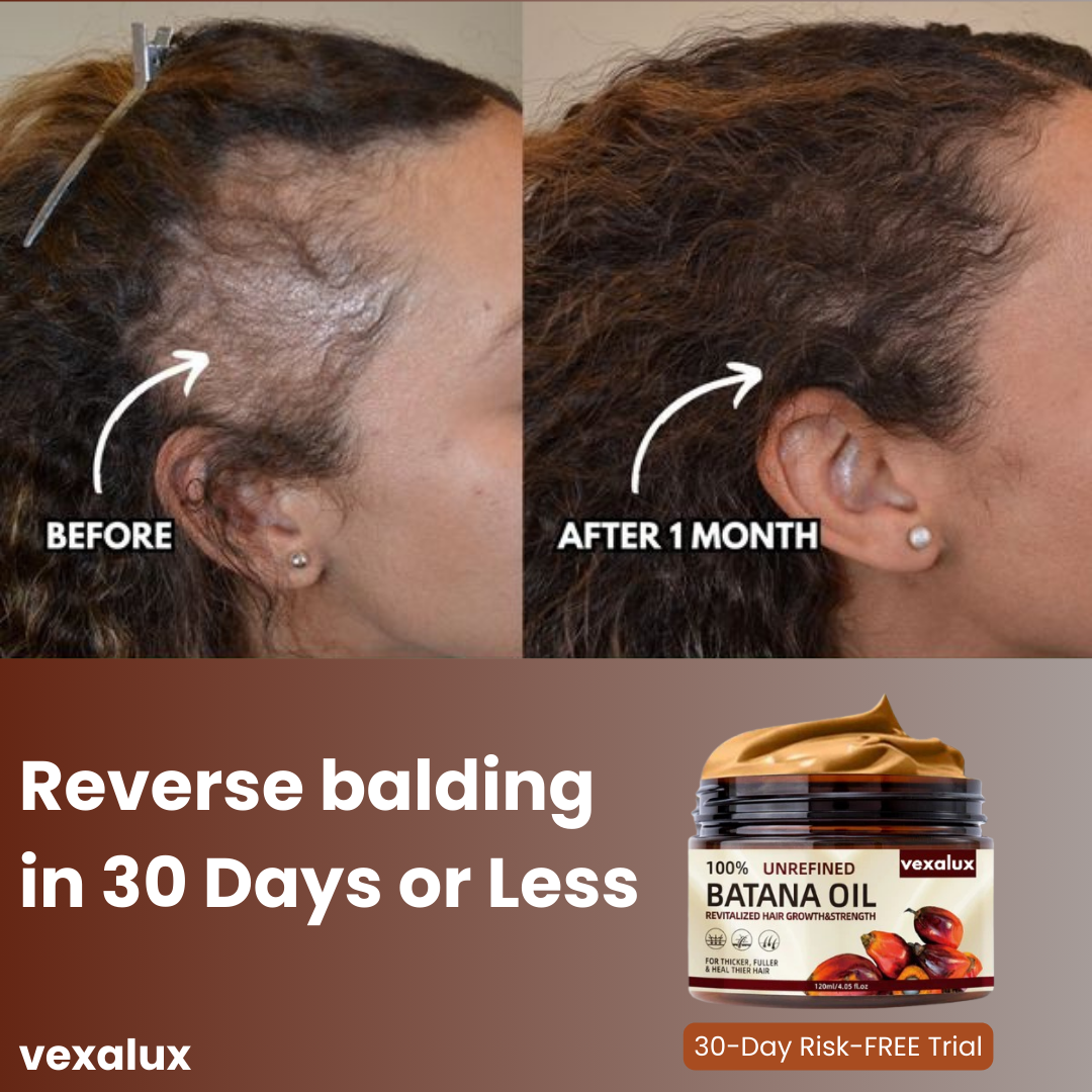 Vexalux™ | 100% Unrefined Batana Oil – Hair Growth, Repair & Deep Scalp Nourishment