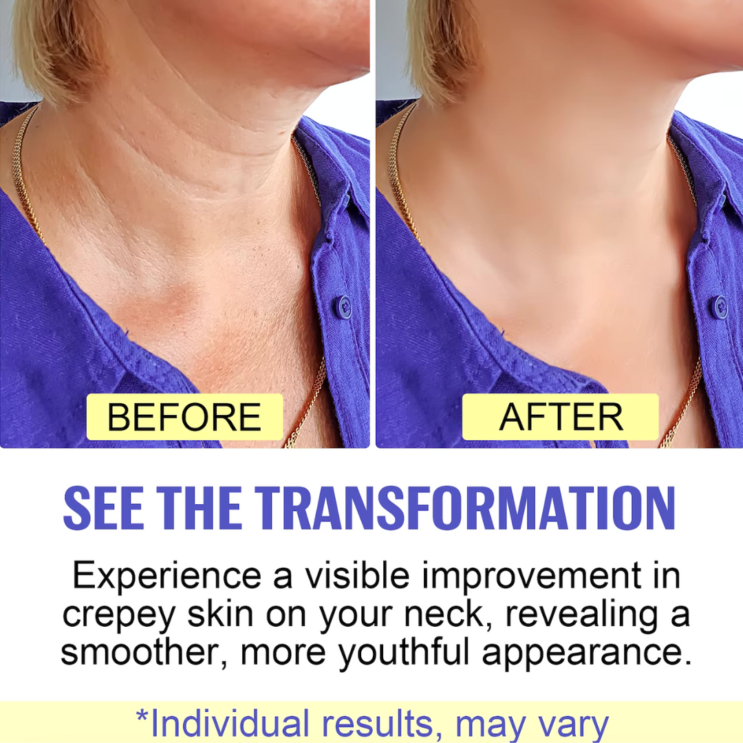FirmNeck™ | Neck Lift Cream